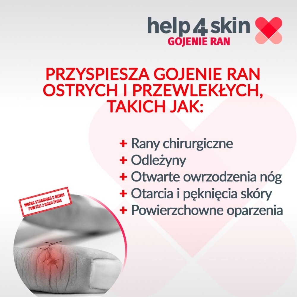 Help4Skin Gojenie Ran spray 75 g
