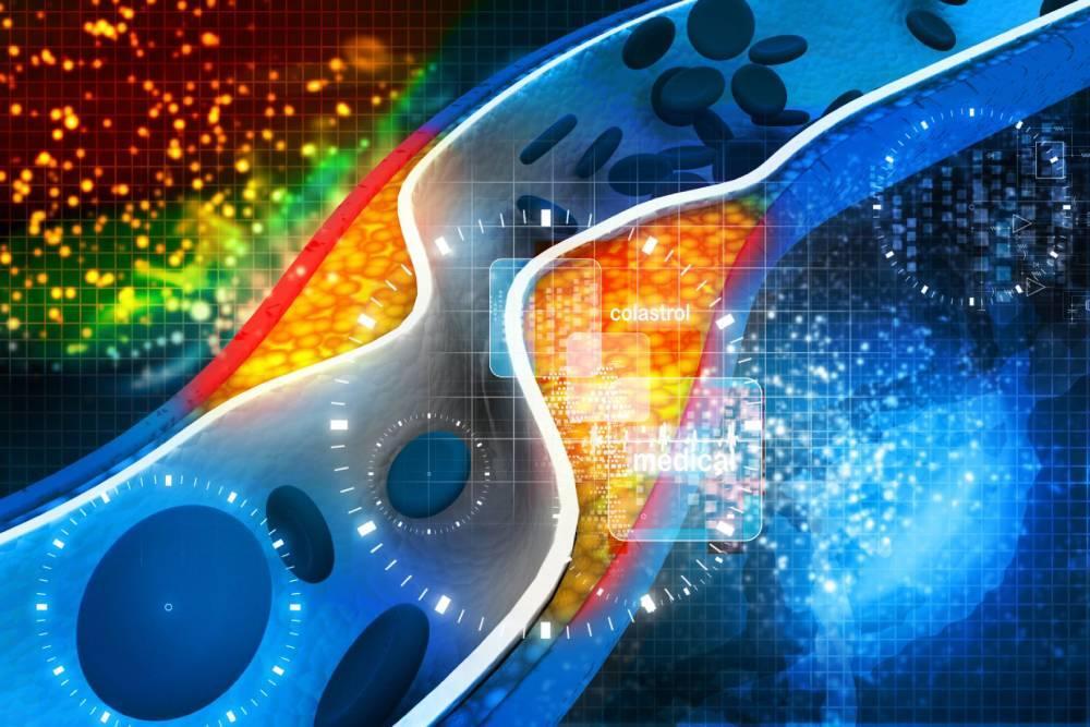 Cholesterol całkowity dobry (HDL) i zły (LDL). Jak obniżyć cholesterol?
