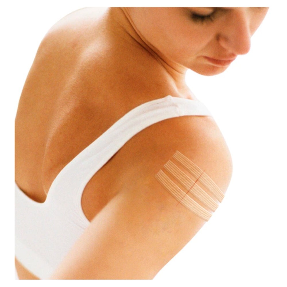 Viscoplast Steri-Strip Paski do zamykania ran białe 2 rozmiary 8 sztuk