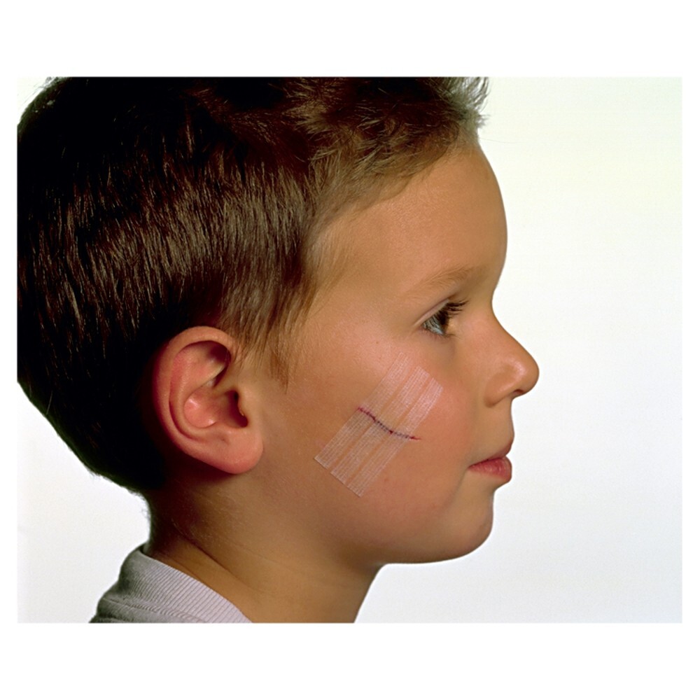 Viscoplast Steri-Strip Paski do zamykania ran białe 2 rozmiary 8 sztuk