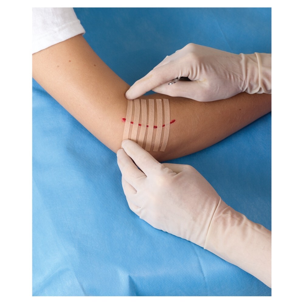 Viscoplast Steri-Strip Paski do zamykania ran cieliste 6 mm x 75 mm 6 sztuk